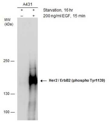 Western Blot: ErbB2/Her2 [p Tyr1139] Antibody [NBP3-12918]